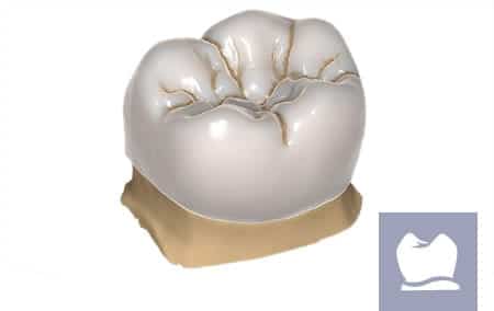 anatomic crowns