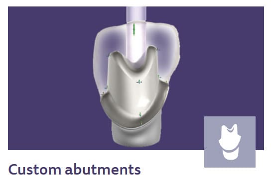 custom abutments