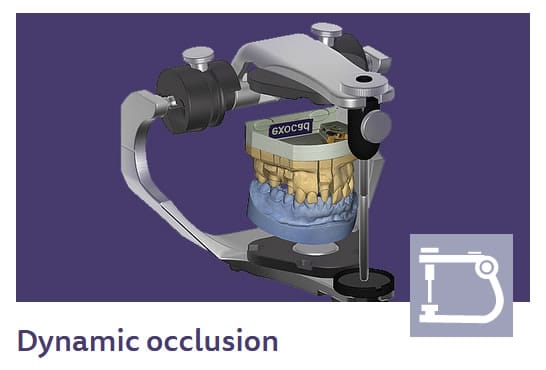 dynamic occlusion