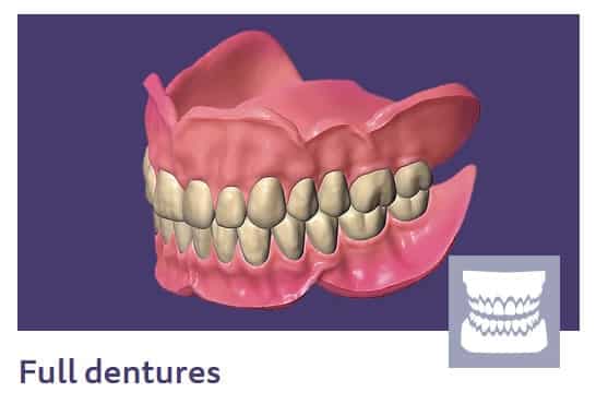 full dentures