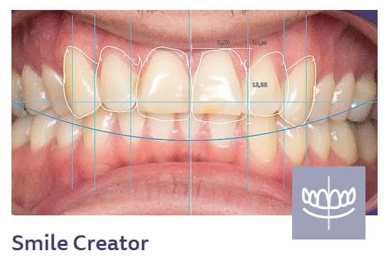 smile creator