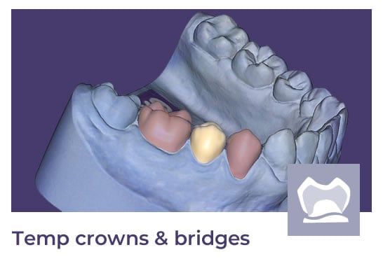 temporary crown and bridges