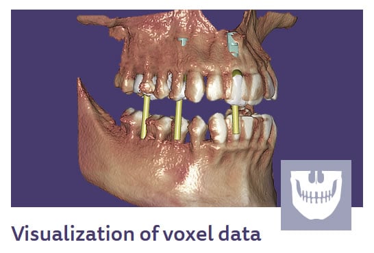 visualization of voxel data